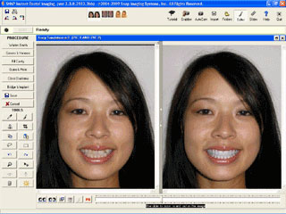 snapdental-7